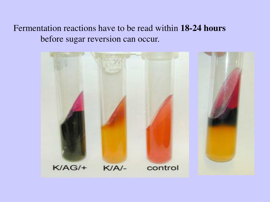 Kia Test Microbiology Results Best KIA