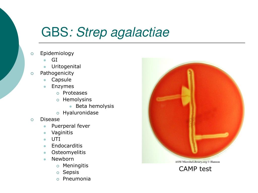 PPT Streptococcus PowerPoint Presentation, free download ID765884