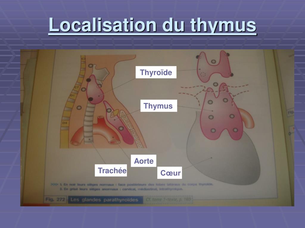 PPT Thymectomie par thoracoscopie PowerPoint Presentation ID773319