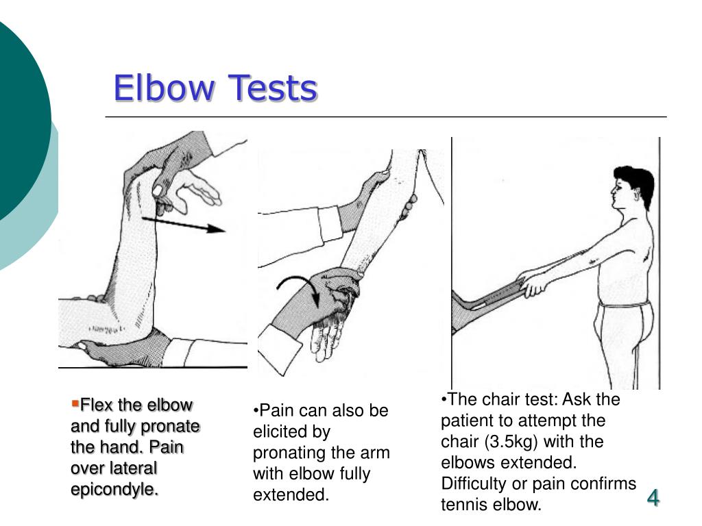 PPT The Elbow PowerPoint Presentation, free download ID777321