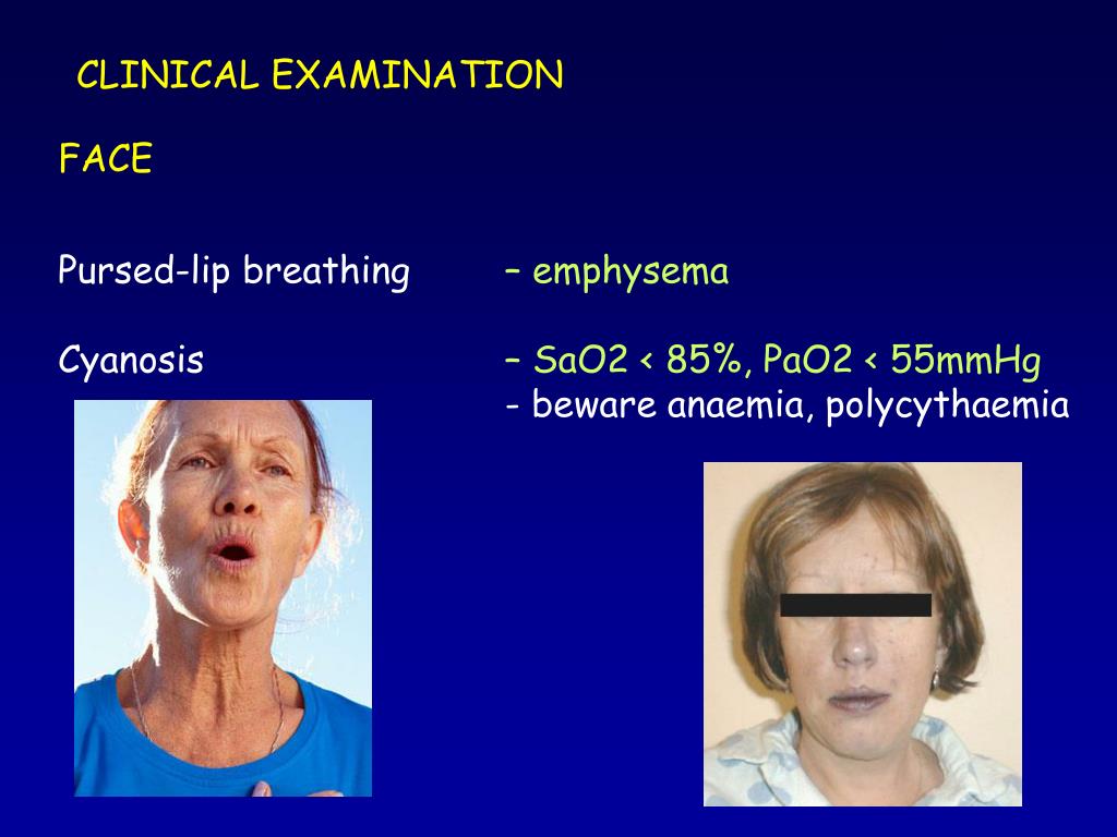 PPT EXAMINATION of the RESPIRATORY system PowerPoint Presentation