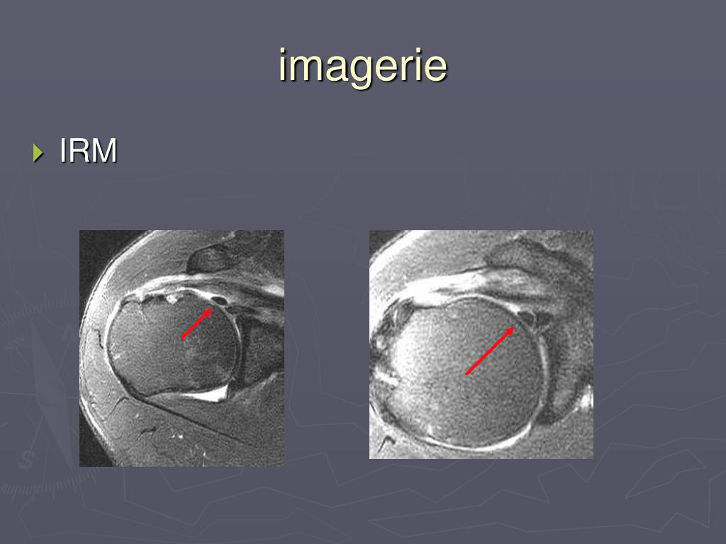 PPT Physiopathologie PowerPoint Presentation, free