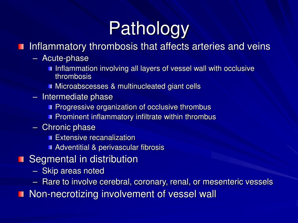 PPT Thromboangiitis Obliterans Buerger’s Disease PowerPoint