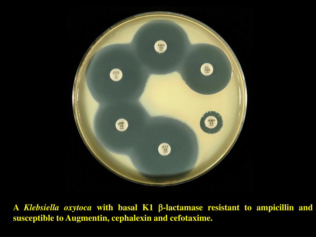 PPT Klebsiella oxytoca and K1 enzyme (indole positive) Chromosomal R