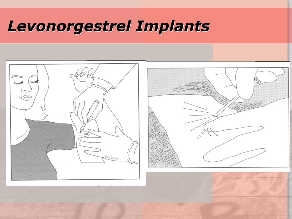 PPT Family Planning PowerPoint Presentation, free download ID823112
