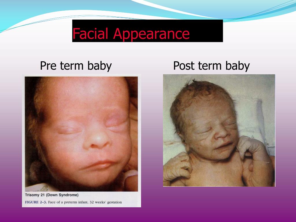 PPT CLINICAL EXAMINATION IN NEONATES PowerPoint Presentation, free