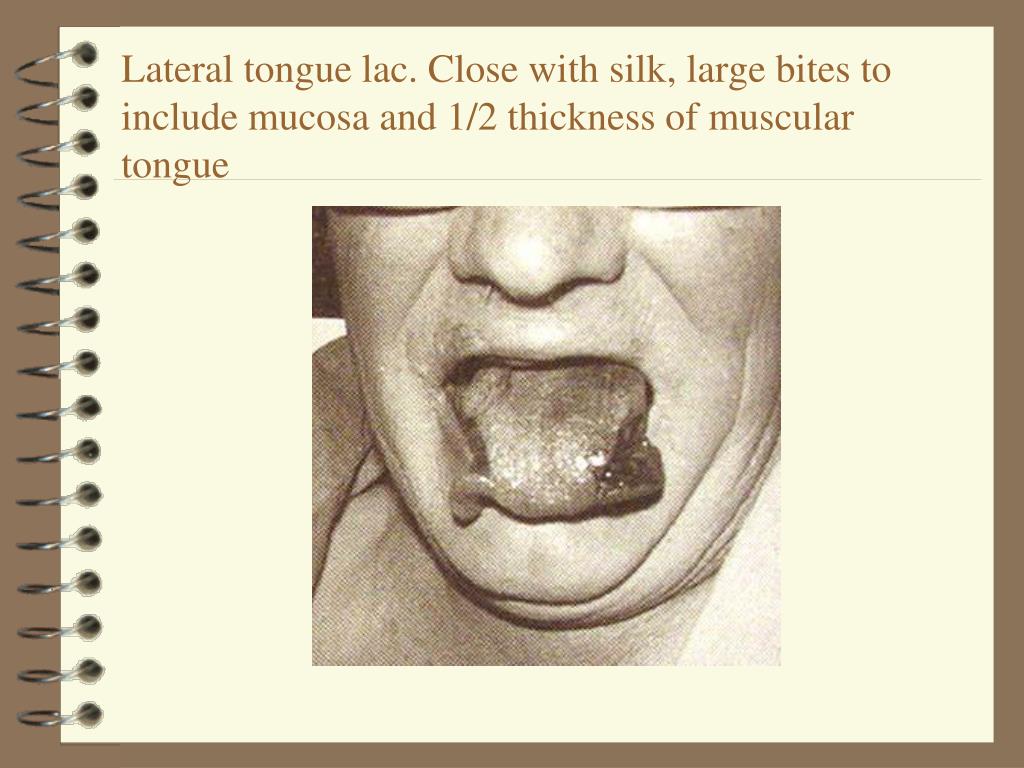 PPT Facial lacerations PowerPoint Presentation, free download ID838514