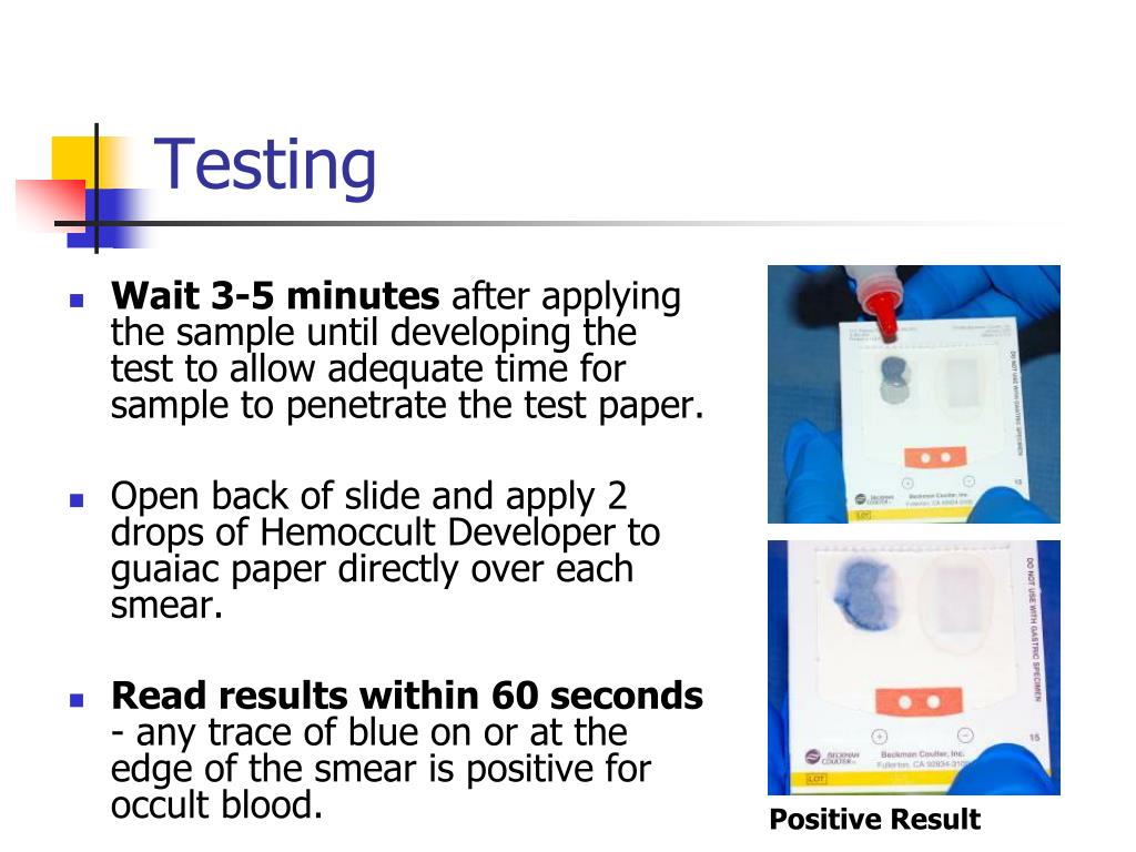 PPT Point of Care Testing Hemoccult ® Fecal Occult Blood PowerPoint