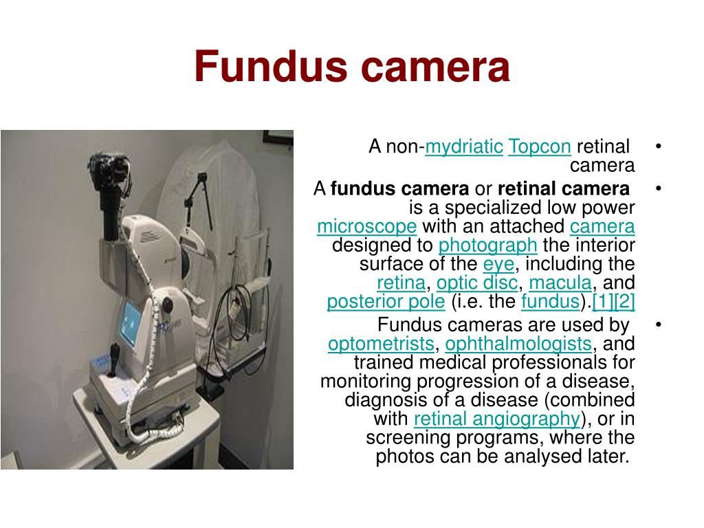 PPT Fundus camera PowerPoint Presentation, free download ID848530