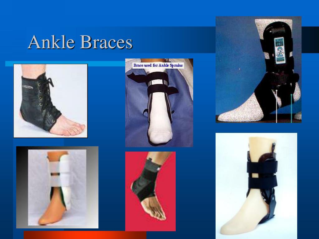 PPT Ankle Anatomy and Exam PowerPoint Presentation, free download