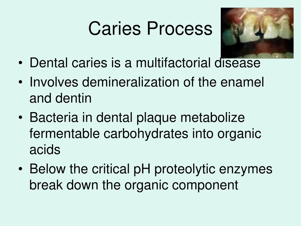 PPT Dental Caries PowerPoint Presentation, free download ID850179
