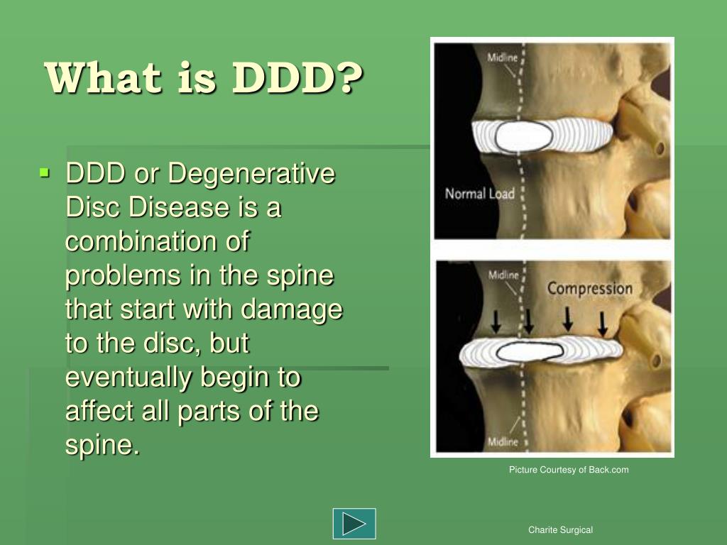 PPT Broward Spine Institute PowerPoint Presentation, free download