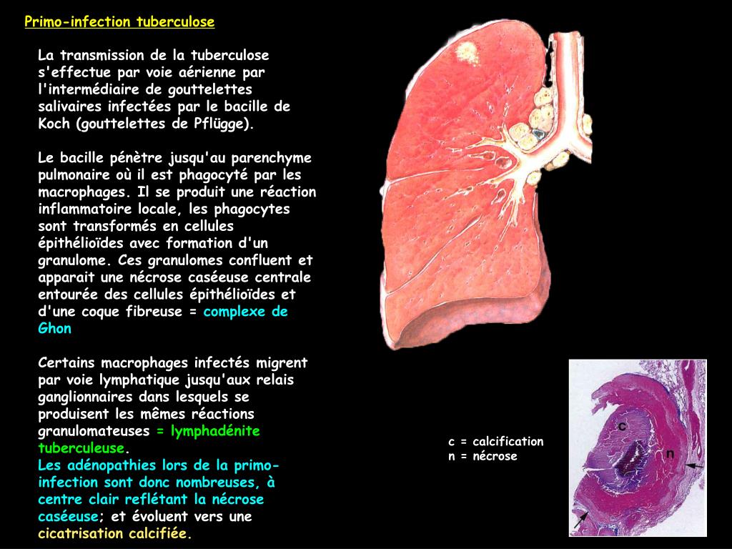 Radiographie D Une Secte Au Dessus De Tout Soupã On By.
