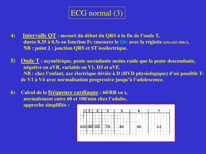 PPT BASES D’INTERPRETATION DE L’ELECTROCARDIOGRAMME PowerPoint Presentation ID873491