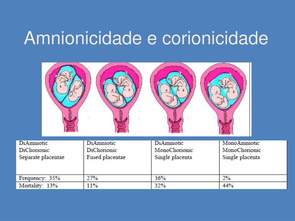 PPT Gestação gemelar PowerPoint Presentation, free download ID877837