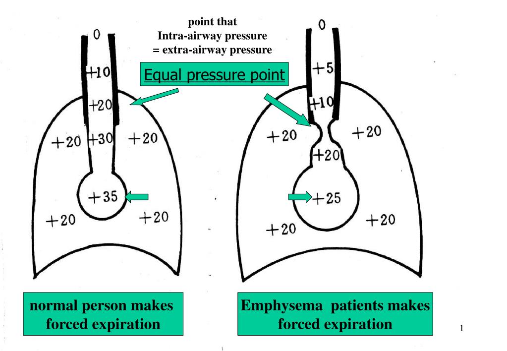 PPT Respiratory Failure PowerPoint Presentation, free