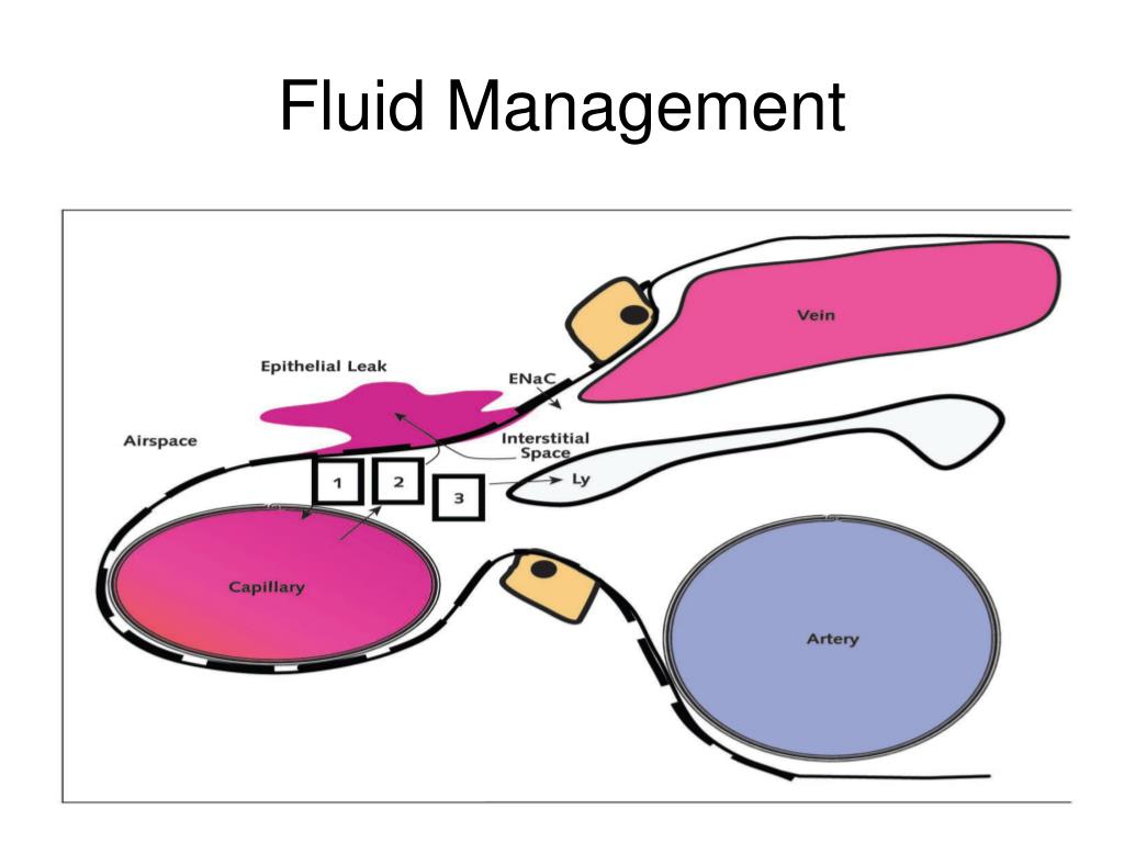 PPT Acute Lung Injury and ARDS PowerPoint Presentation, free download