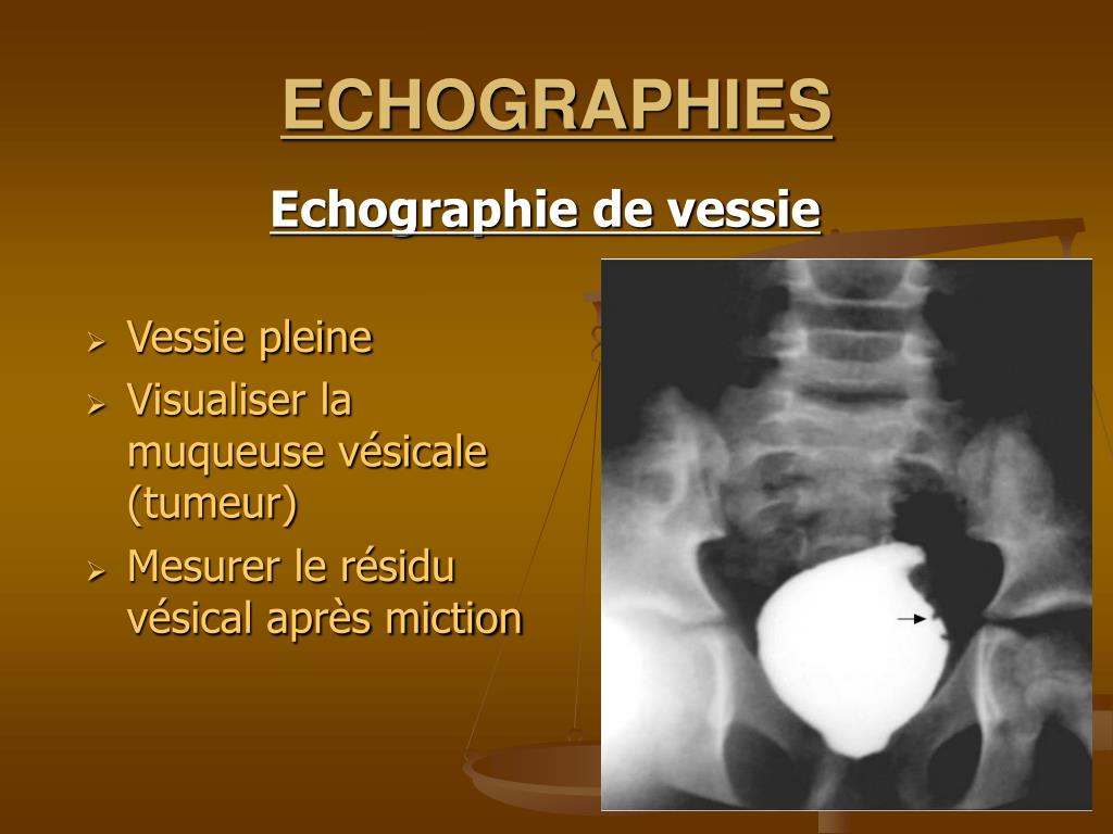 PPT UROLOGIENEPHROLOGIE PowerPoint Presentation, free download ID