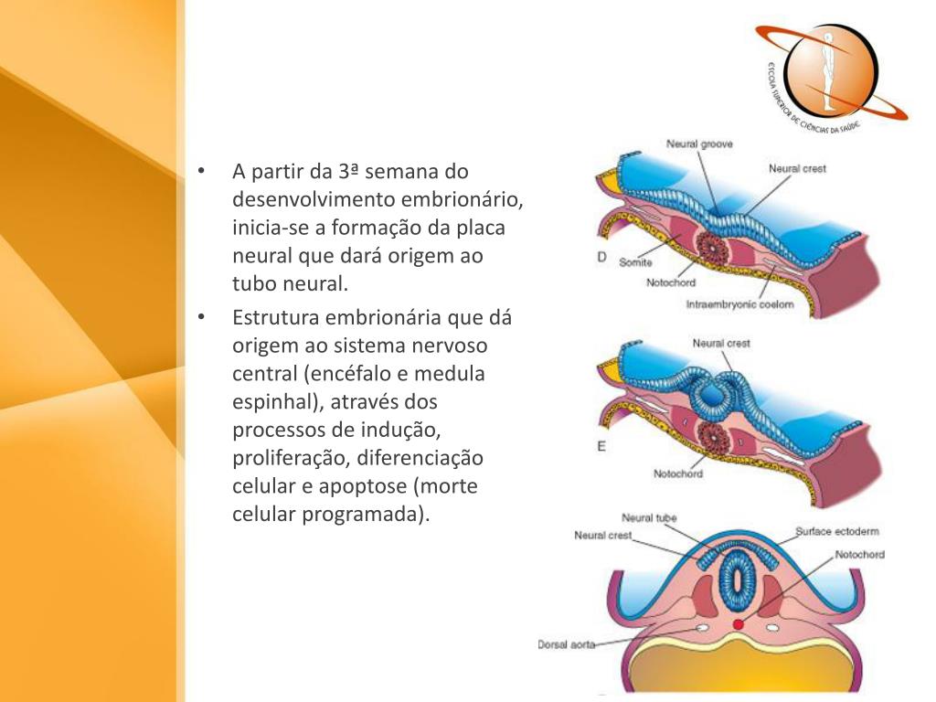 PPT Defeitos de Fechamento do Tubo Neural PowerPoint Presentation