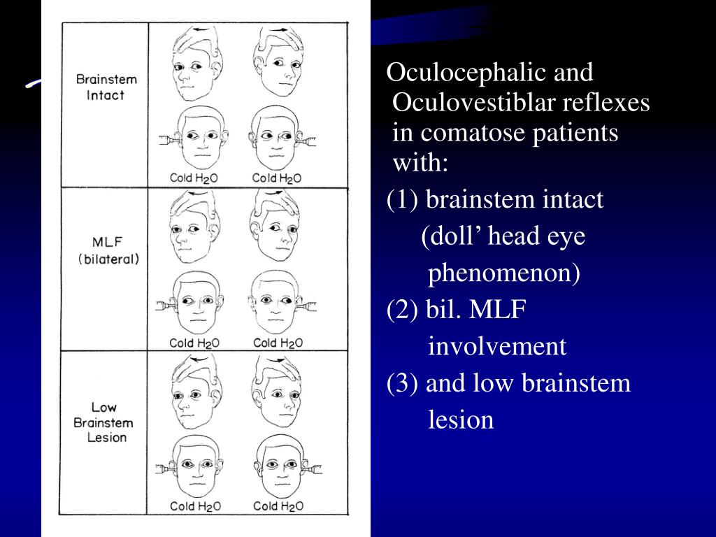 PPT Coma and Brain Death （昏迷與腦死） PowerPoint Presentation ID945586