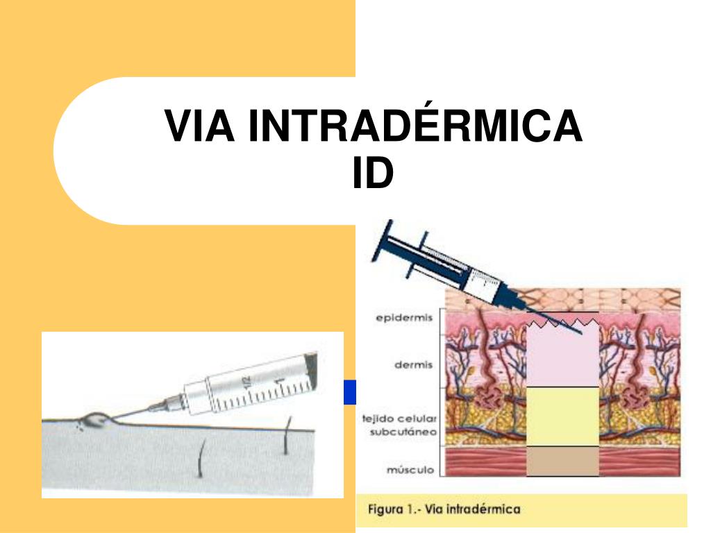 PPT Administração de medicamentos Parenterais PowerPoint Presentation