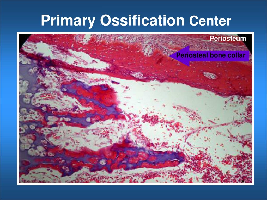 PPT Bone Ossification PowerPoint Presentation, free download ID967643