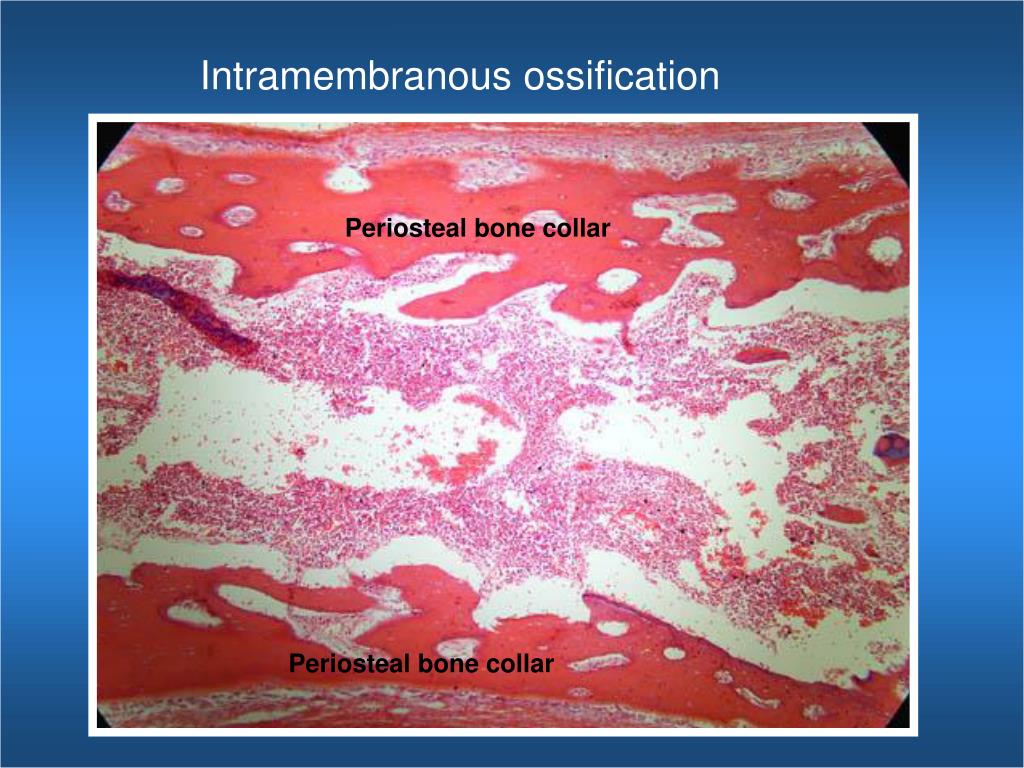 PPT Bone Ossification PowerPoint Presentation, free download ID967643