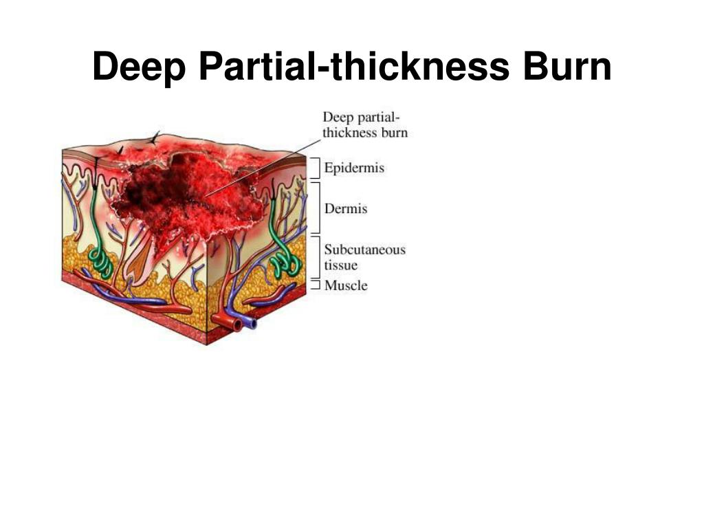 PPT Adult Health PowerPoint Presentation, free download ID969906