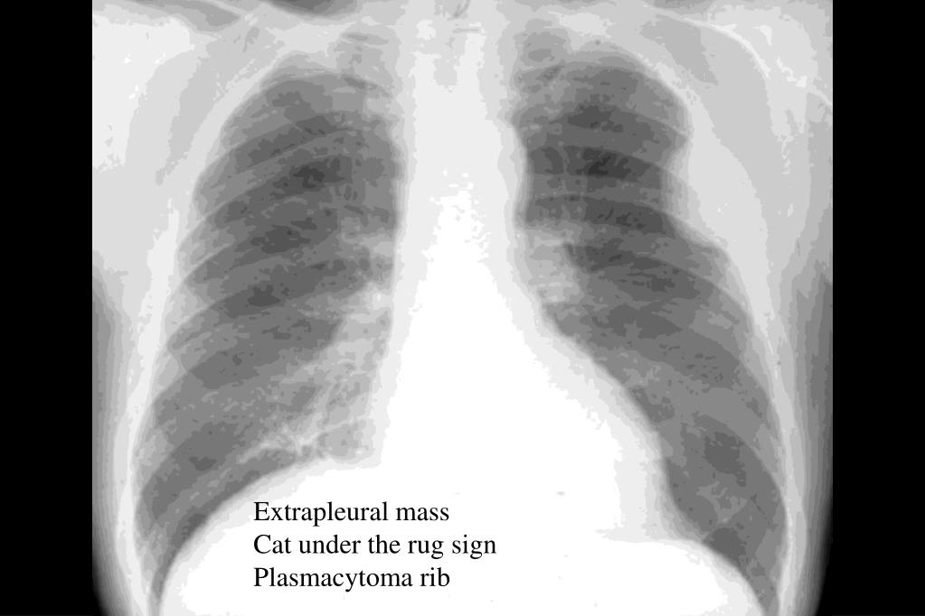 PPT Chest XRays Every Resident Should Know Part 2 PowerPoint