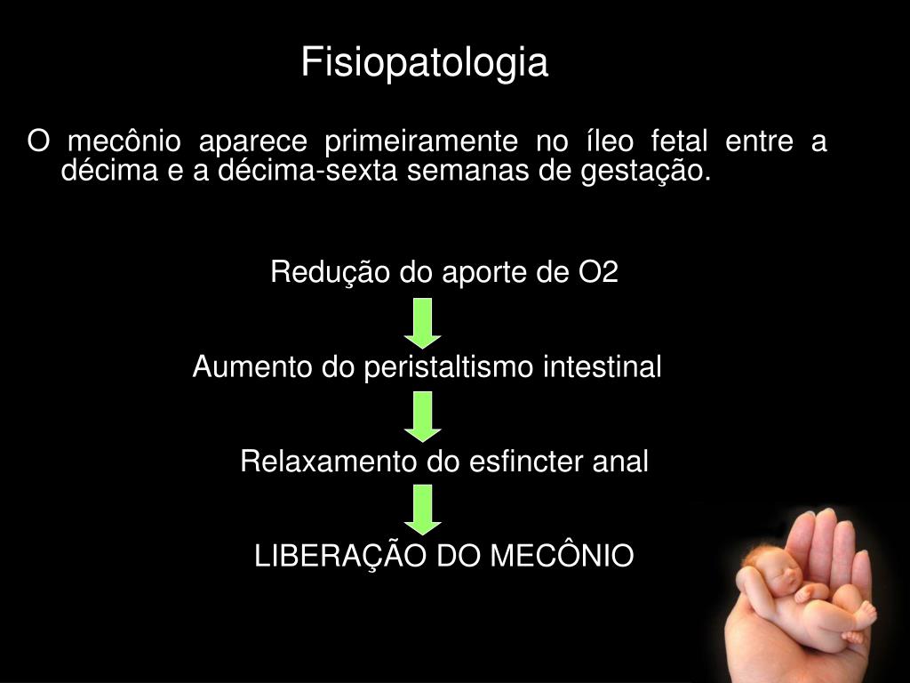 PPT Síndrome de Aspiração de Mecônio PowerPoint Presentation, free