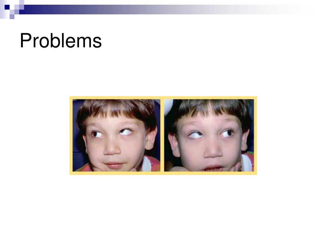 PPT Binocular Vision and Space Perception PowerPoint Presentation