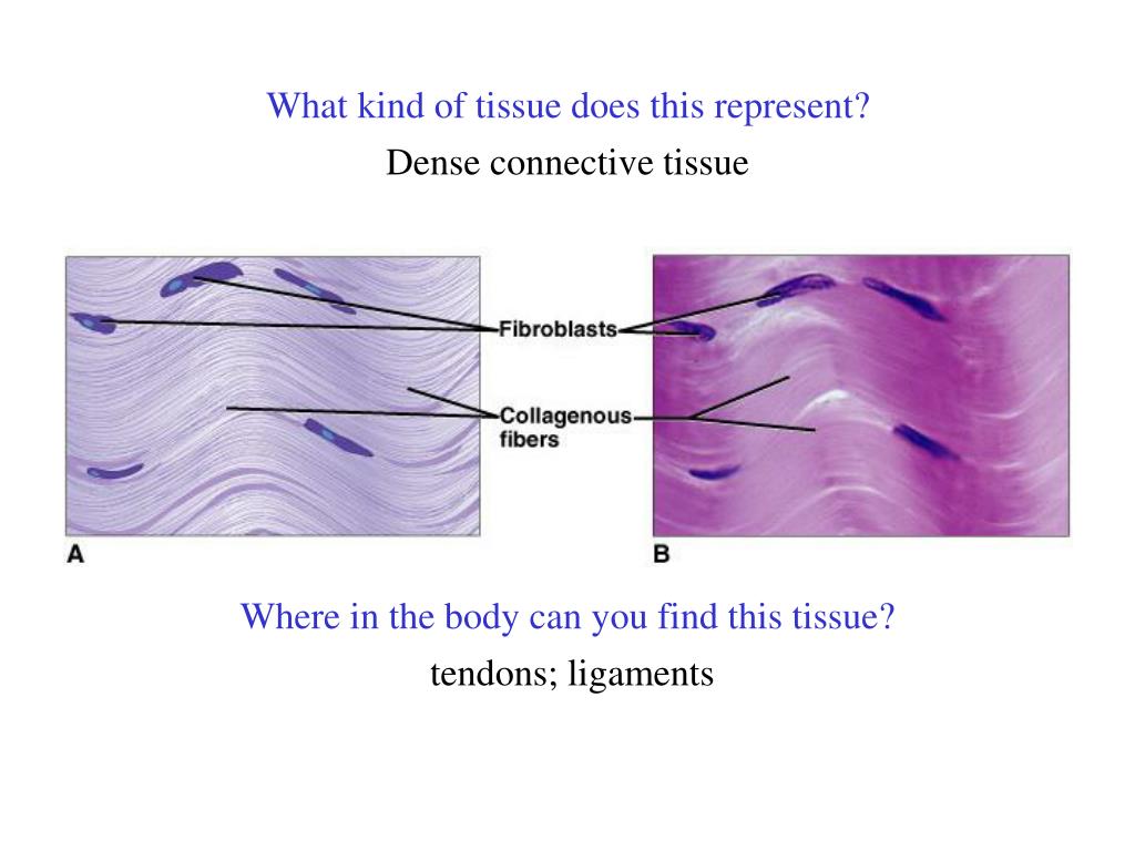 PPT The following types of connective tissue are covered in this