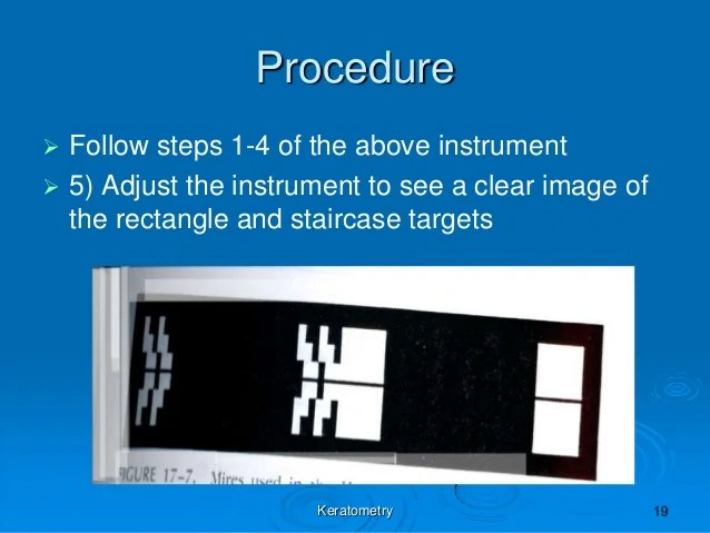 keratometry