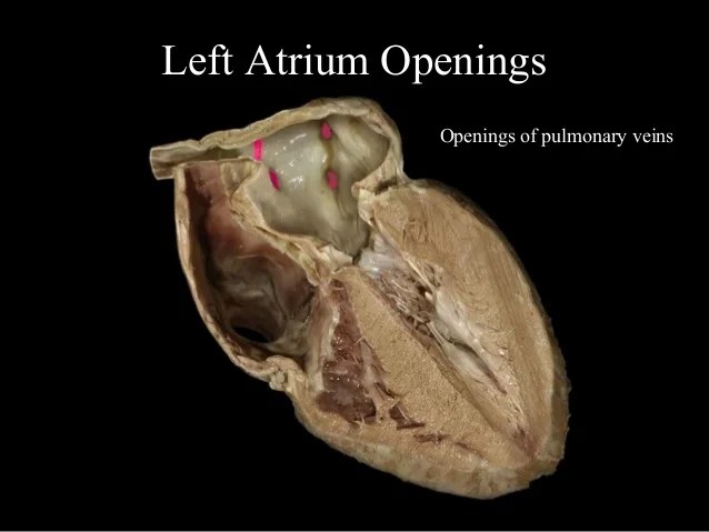 20 lecture apr ppt