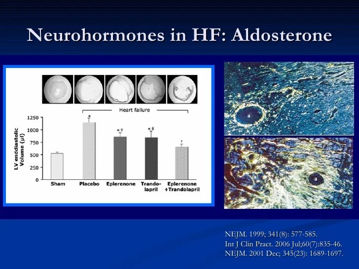 Evidencebased management of CHF