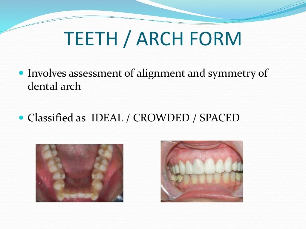 Ackerman & proffit classification of malocclusion