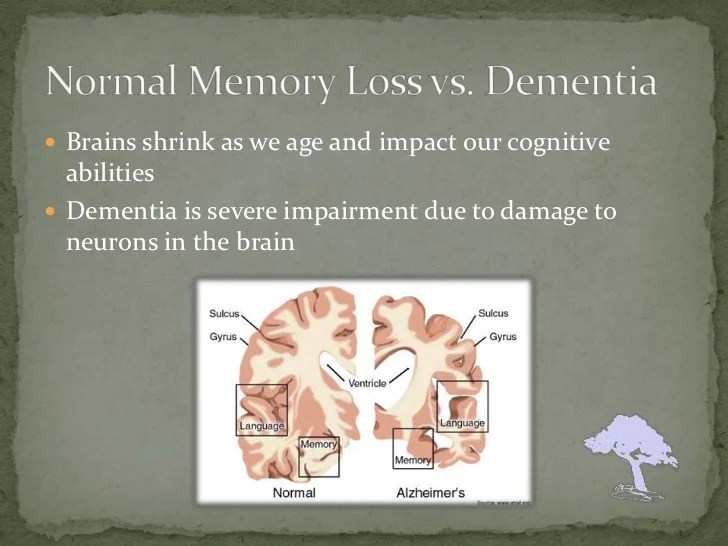 Is It Normal or Is It Dementia?