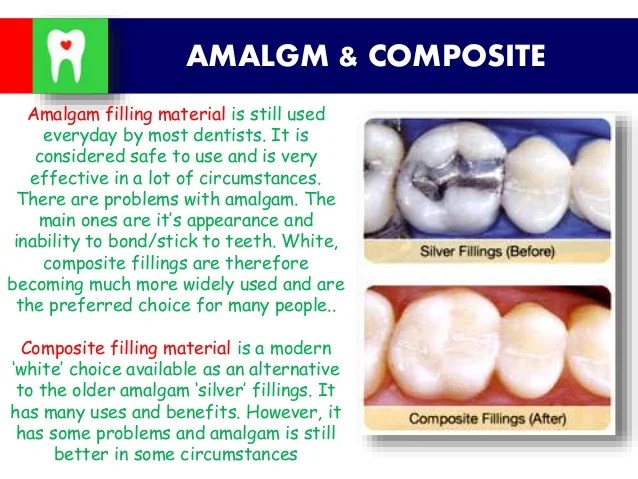 Amalgam
