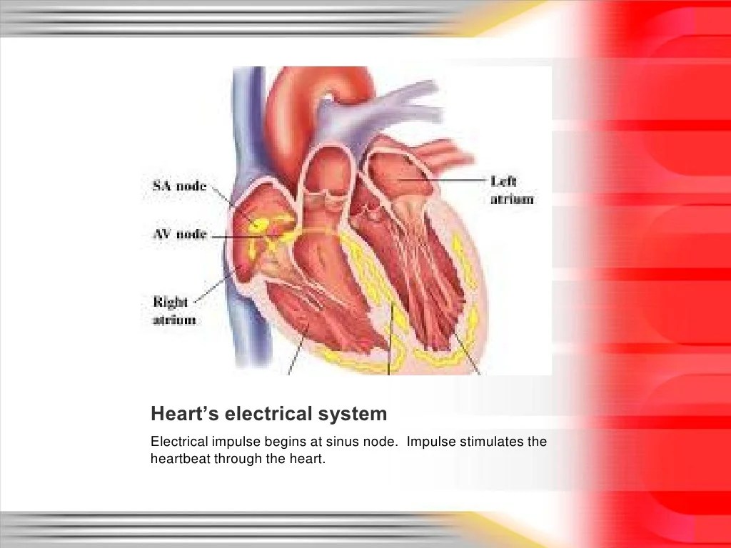Arrhythmia basics