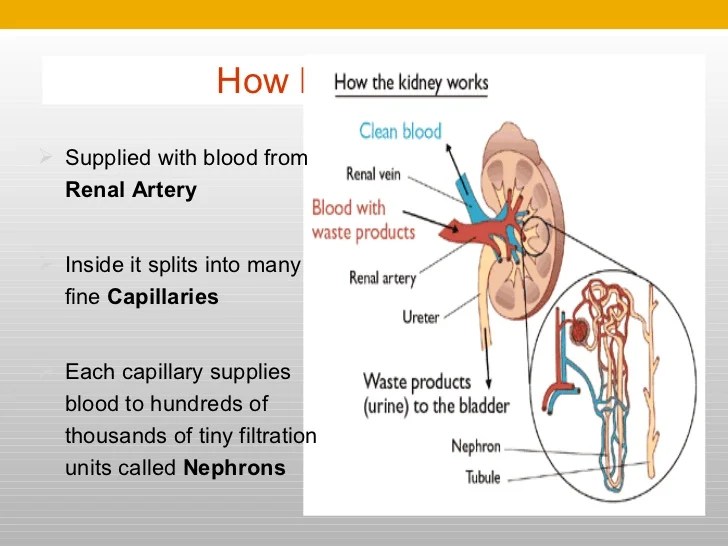 Artificial kidney