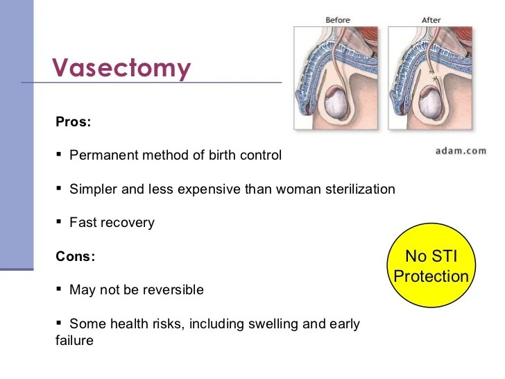 Birth Control Methods