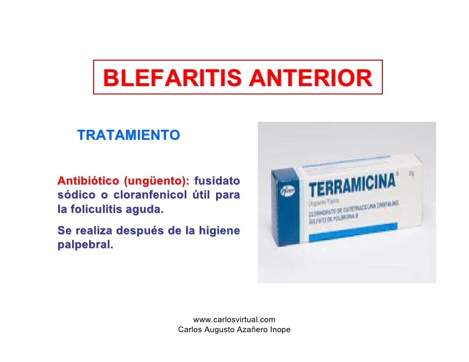 BLEFARITIS TRATAMIENTO FARMACOLOGICO PDF
