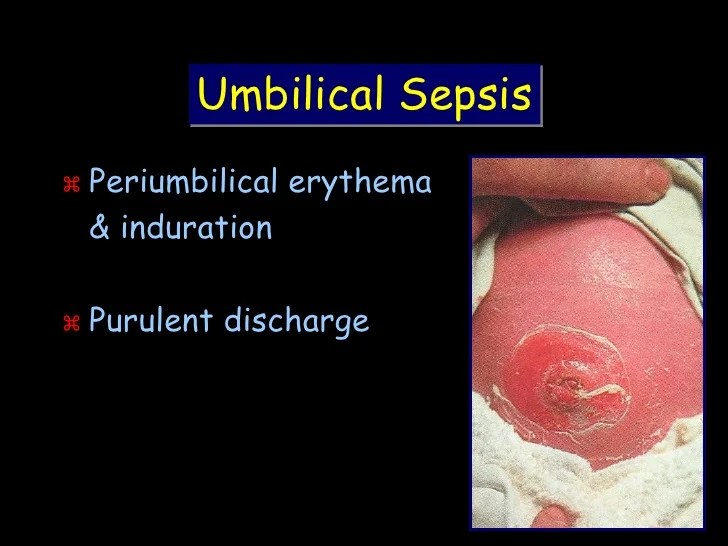 Common neonatal problems