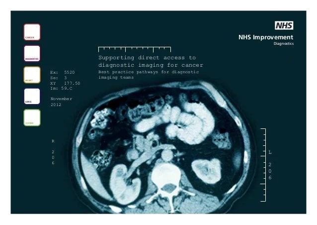 How Much Does A Brain Scan Cost The Nhs mri scan machine