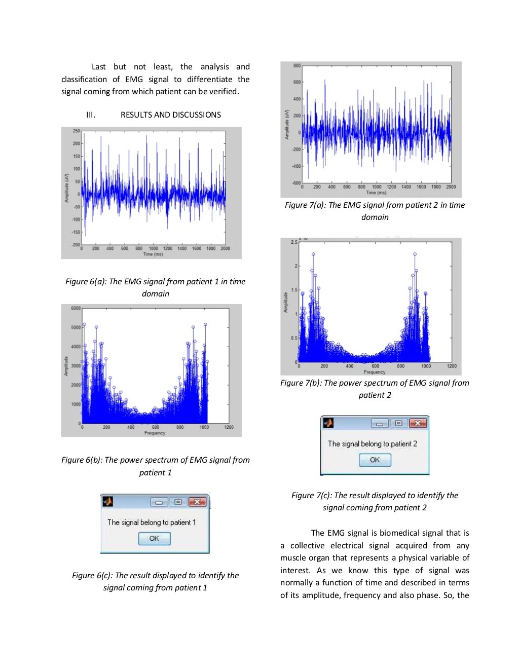Dsp lab report Analysis and classification of EMG signal using MATLA…