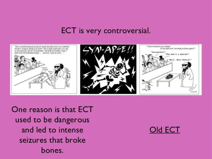 Ect2