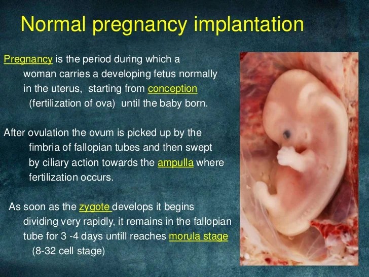 Ectopic Pregnancy Implantation Bleed maternity photos