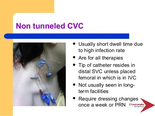 Essentials of vascular access