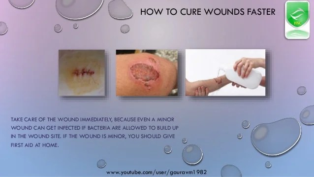 How To Cure Wounds Faster