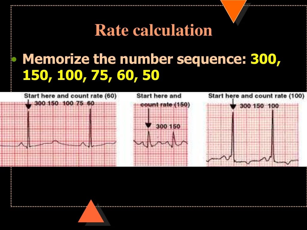 How to read ECG